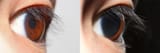 Pupillary_light_reflex