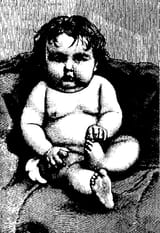 ugly baby