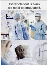 amputate