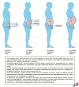 male_pregnancy_developing_by_althea9_d5bsder-pre