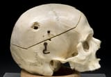 Gunshot_skull