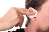 man-bleeding-from-his-ears-min-scaled
