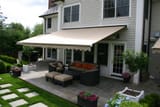Retractable+awning