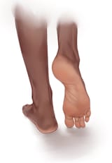 foot_dark