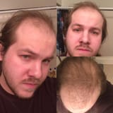 Thread 18473595 OP Image