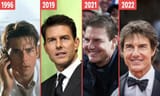 tom-cruise-plastic-surgery-milano-clinic-turkey-1024x615-4025205454
