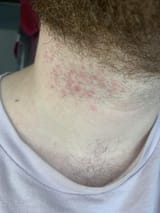 Thread 18476844 OP Image