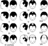 1731698733935305