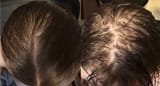hair (2)