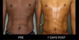 ab etching lol