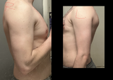Scapula