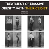 1975_massive_obesity