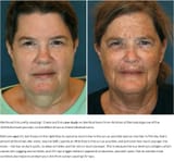 sun-damage-twins-skin