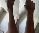 extremely-thin-wrists-or-forearm