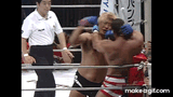 Frye &amp; Takayama Facial Obliteration