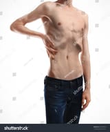 stock-photo-skinny-young-man-with-anorexia-on-white-background-434031862