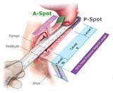 vaginal_fornices