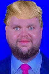 vance-trump-hair