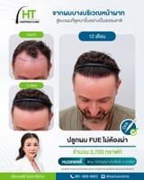 1720927504686703