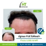 1733738955946860