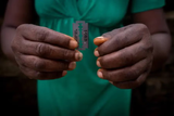 fgm