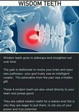 wisdom-teeth