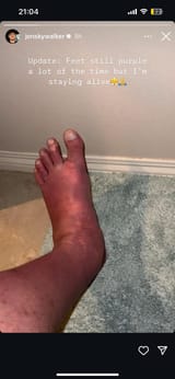 feet