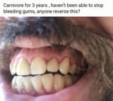 1726122630636340