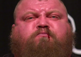 HEMMORRHOID MAN