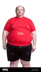 obese-man-at-400lbs-front-BT363F
