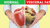 visceral fat