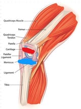 kneehab