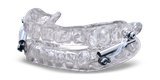 silent_nite_glidewell_hinge_v2