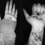what-is-self-harm