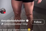 leg