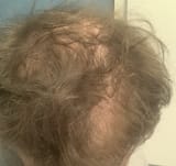 Thread 76409880 OP Image