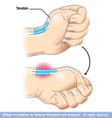 thumb adduction