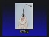 kyne