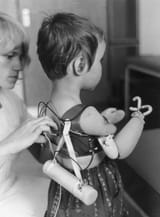 contergan baby - trust the doctors!