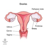 22999-ovaries