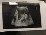 fetus_thumbsup