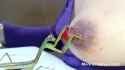Mantis suckling blood from the nipple of a breast which it is devouring_thumb.jpg