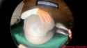 1722372599071_thumb.jpg