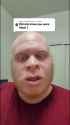Albino Black Guy_thumb.jpg
