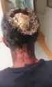 Itchy Scalp_thumb.jpg
