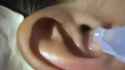 ear fren_thumb.jpg