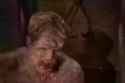 Leper Porn_thumb.jpg