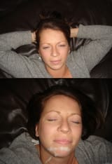 Before___After_facial