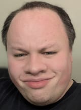 1749125988456 Finn Finnish man borreby Yamnaya EHG ANE Australoid ASI negroid abbo phenotype