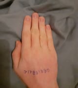 I forgot to put sunscreen on my hand